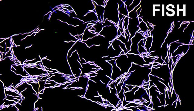 Fluoreszenzmikroskopisches Bild von Taurinivorans muris in Reinkultur 