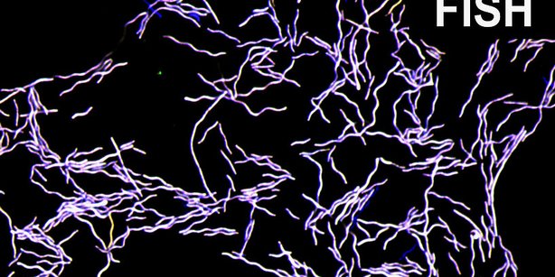 Fluoreszenzmikroskopisches Bild von Taurinivorans muris in Reinkultur 