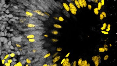 Picture of the view onto a worms eye.