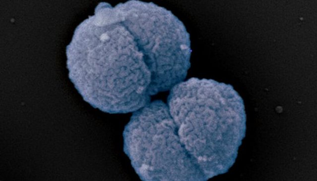 Zu sehen ist die Neisseria gonorrhoeae, der Erreger der Tripper auslöst. Das Aussehen ist mit einem kleinen blauen Gehirn gleichzusetzen - auf schwarzem Hintergrund.