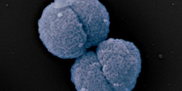 Zu sehen ist die Neisseria gonorrhoeae, der Erreger der Tripper auslöst. Das Aussehen ist mit einem kleinen blauen Gehirn gleichzusetzen - auf schwarzem Hintergrund.